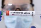 Volvió la viruela del mono: la OMS decretó nuevamente la emergencia sanitaria mundial