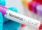 Un brote de norovirus afectó a 180 estudiantes mientras disfrutaban de su viaje de egresados en Bariloche.