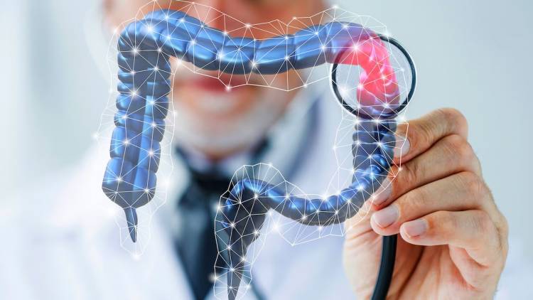 Cáncer de colon: cómo es el test simple e innovador con el que muchas personas podrían evitar la colonoscopia