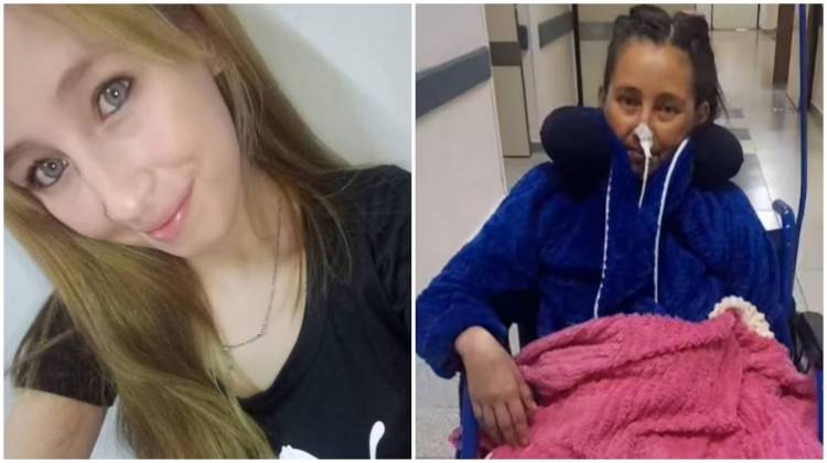 Fue a ligarse las trompas y terminó con una pierna amputada y un trasplante de corazón: la pesadilla de Alison